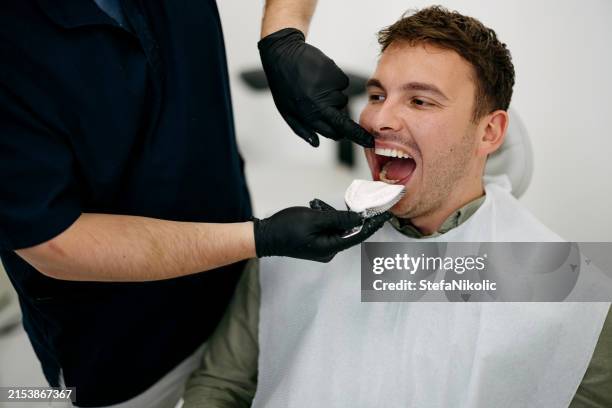 taking a dental impression - dental mould stock pictures, royalty-free photos & images