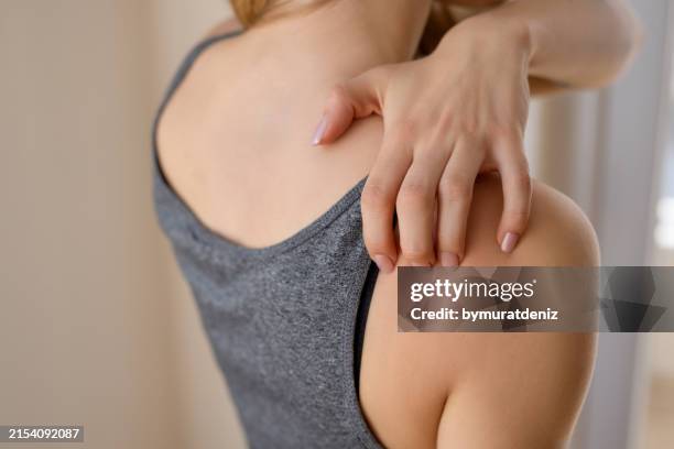 femme se grattant le dos - irritation cutanée photos et images de collection