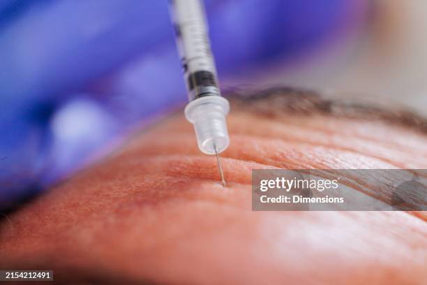 macro view of needle on wrinkled skin - doctor forehead stock pictures, royalty-free photos & images