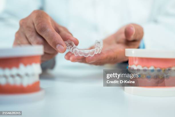 allineatori dentali - apparecchio ortodontico foto e immagini stock