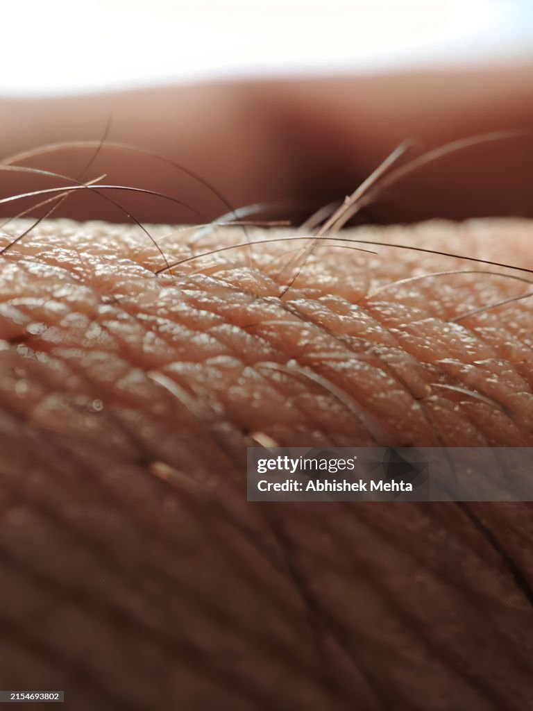 Goose bumps macro