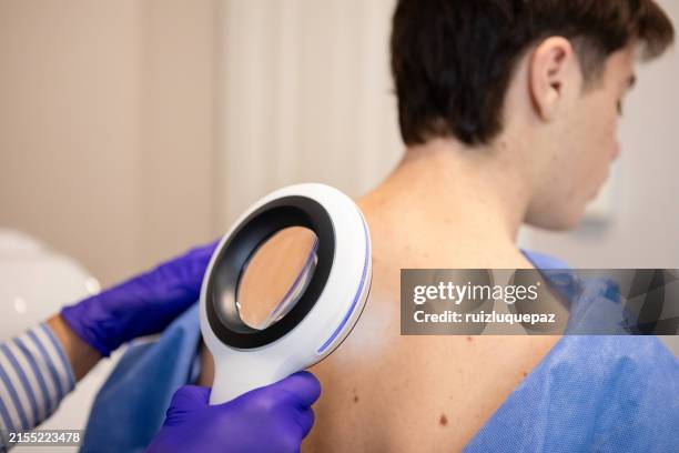 dermatologist examining her patient with a dermatological magnifying glass - dermatology stock pictures, royalty-free photos & images