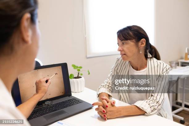 dermatologist in consultation with female patient - mole skin stock pictures, royalty-free photos & images