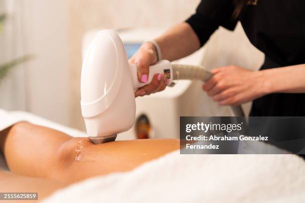 worker using laser to remove hair on legs of a patient - zuid europese etniciteit stockfoto's en -beelden