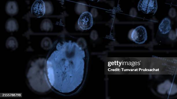 Ct Scan Brainline 275 Ct Scan Brain Anatomy Stock Photos, High-Res Pictures, and Images ...