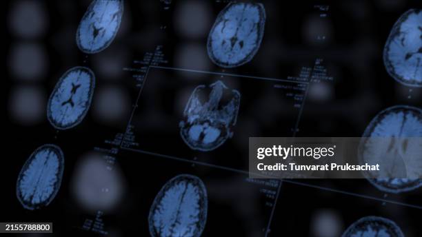 magnetic mri scan. brain. - exame de ressonância magnética imagens e fotografias de stock