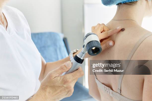 dermatological skin examination - stock photo - melanoma stock pictures, royalty-free photos & images