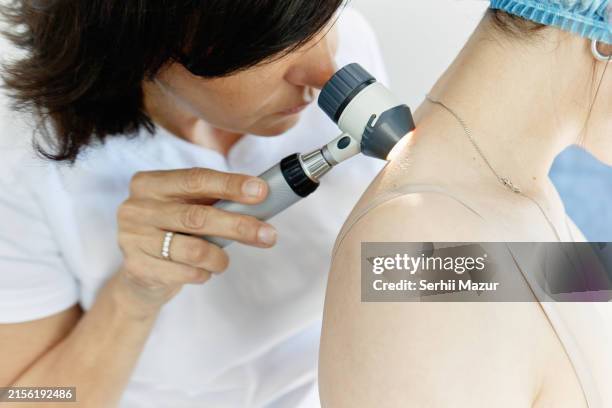 dermatological skin examination - stock photo - biopsia imagens e fotografias de stock