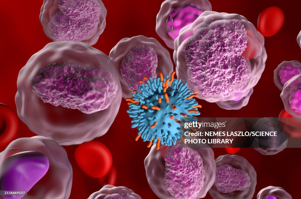 CAR-T cell attacking non-Hodgkin's lymphoma cells, illustration