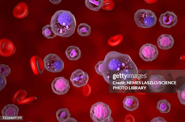 multiple myeloma, illustration - myeloma stock illustrations