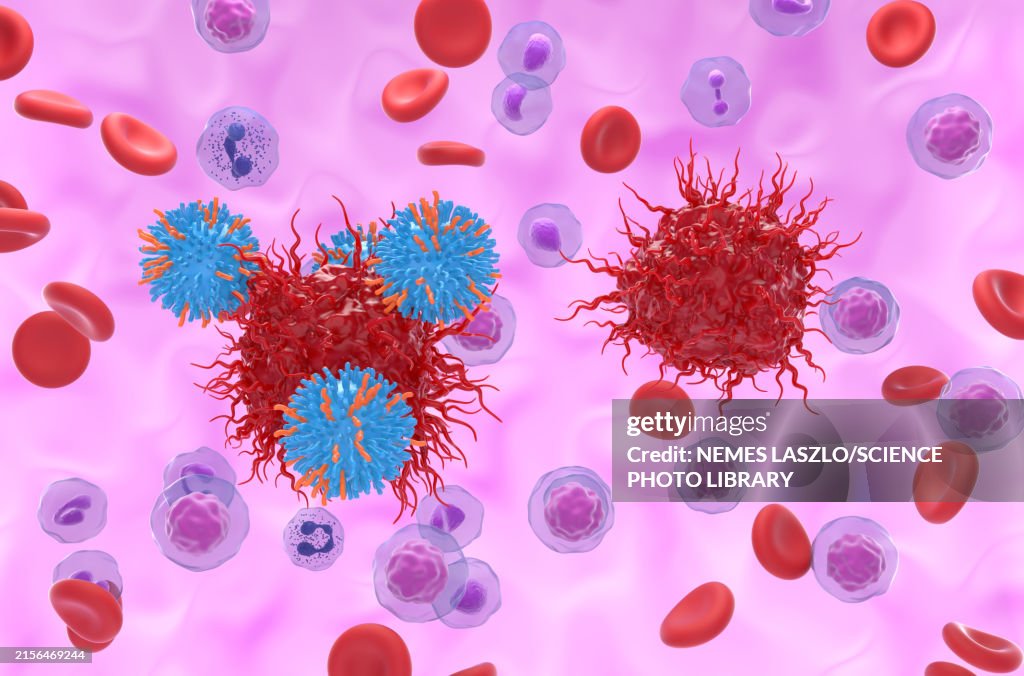 CAR-T cells attacking euroendocrine tumour cells, illustration