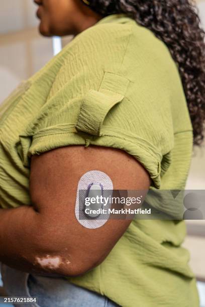 close-up of continuous glucose monitor on arm - continuous glucose monitor stock pictures, royalty-free photos & images