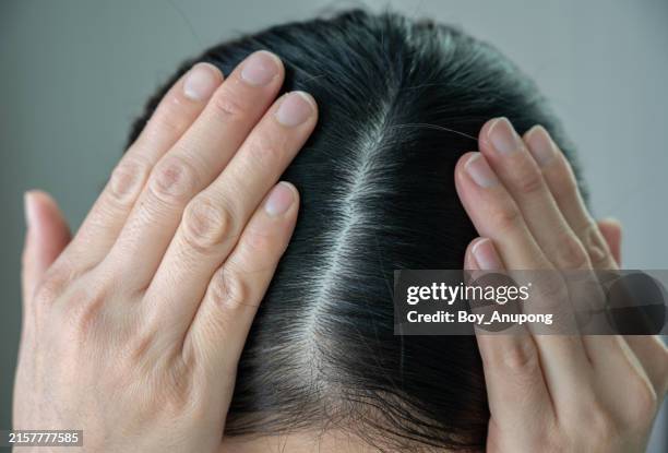 thin hair spot on asian woman head. female pattern hair loss can progress from a widening part to overall thinning. - human scalp stock pictures, royalty-free photos & images
