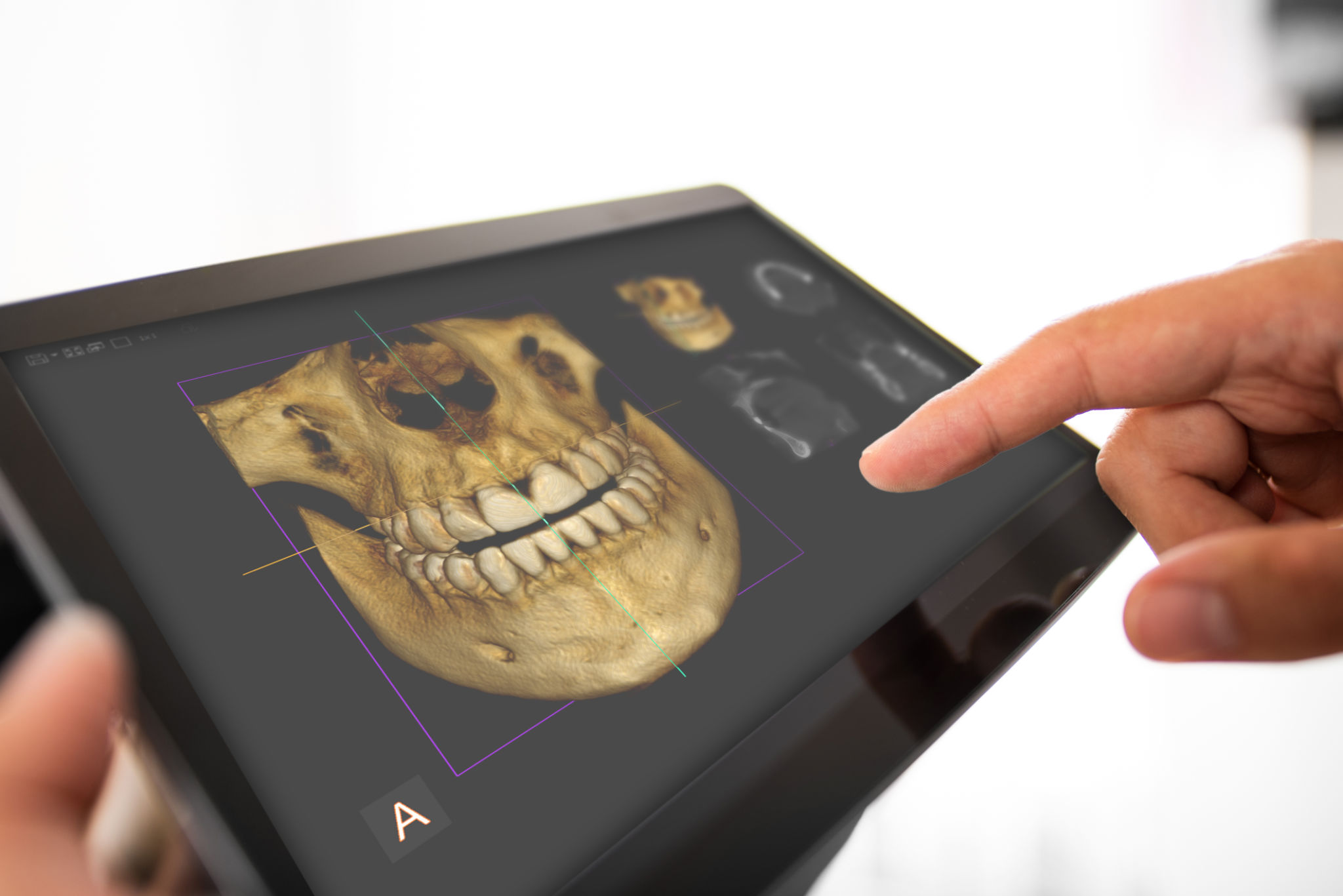 3D imaging