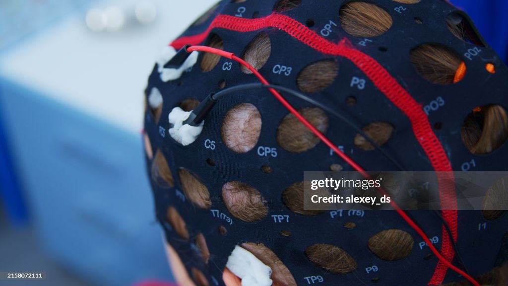 Se usa un gorro de EEG para proporcionar una prueba de actividad cerebral