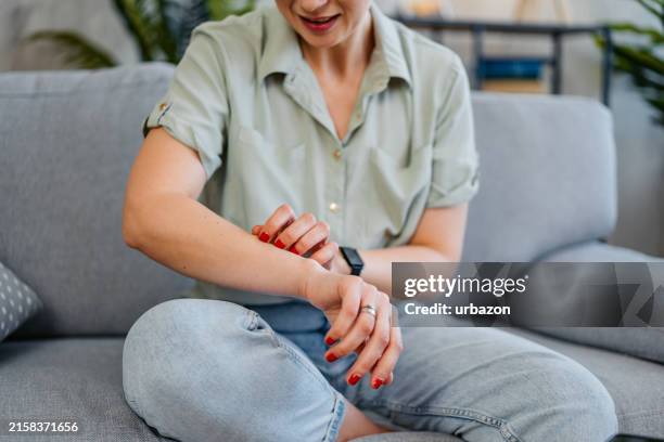 mid-adult woman scratching her skin at home - unterarm stock-fotos und bilder