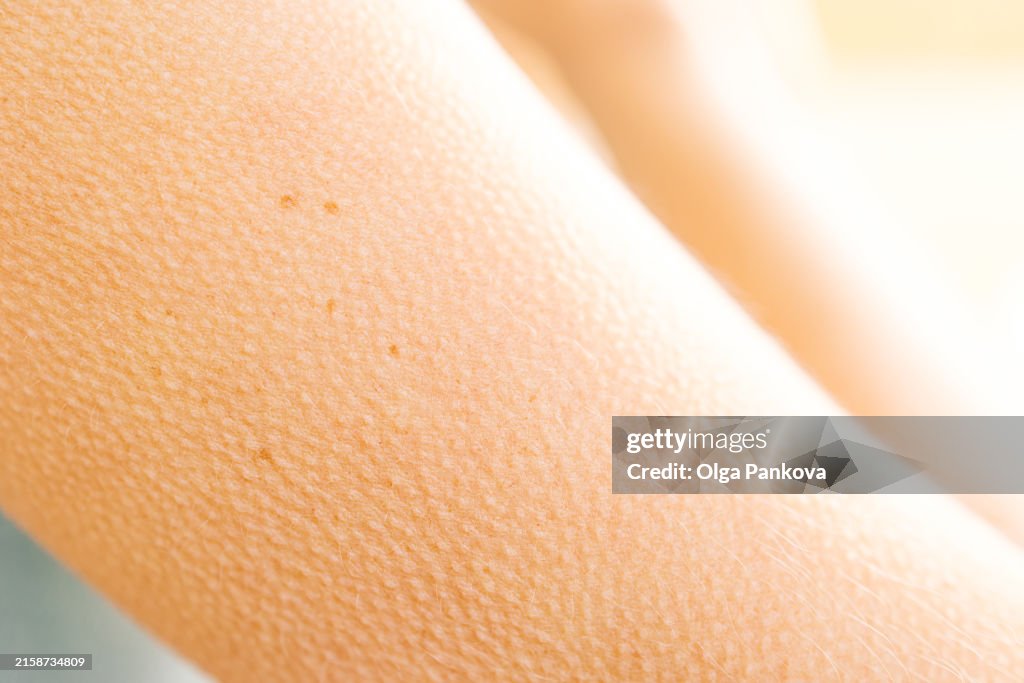Skin texture with goosebumps