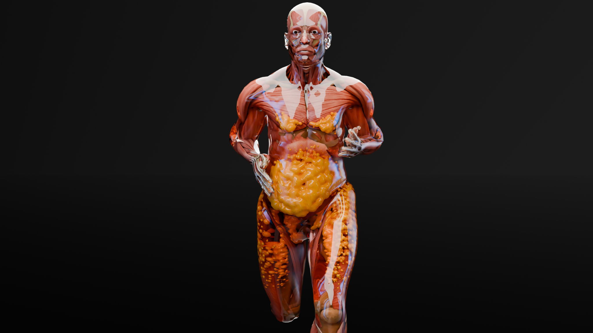 metabolic disorder