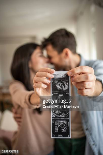 a happy couple, a brazilian woman and a white man show an ultrasound image, they will have a baby - ultrasound stock pictures, royalty-free photos & images