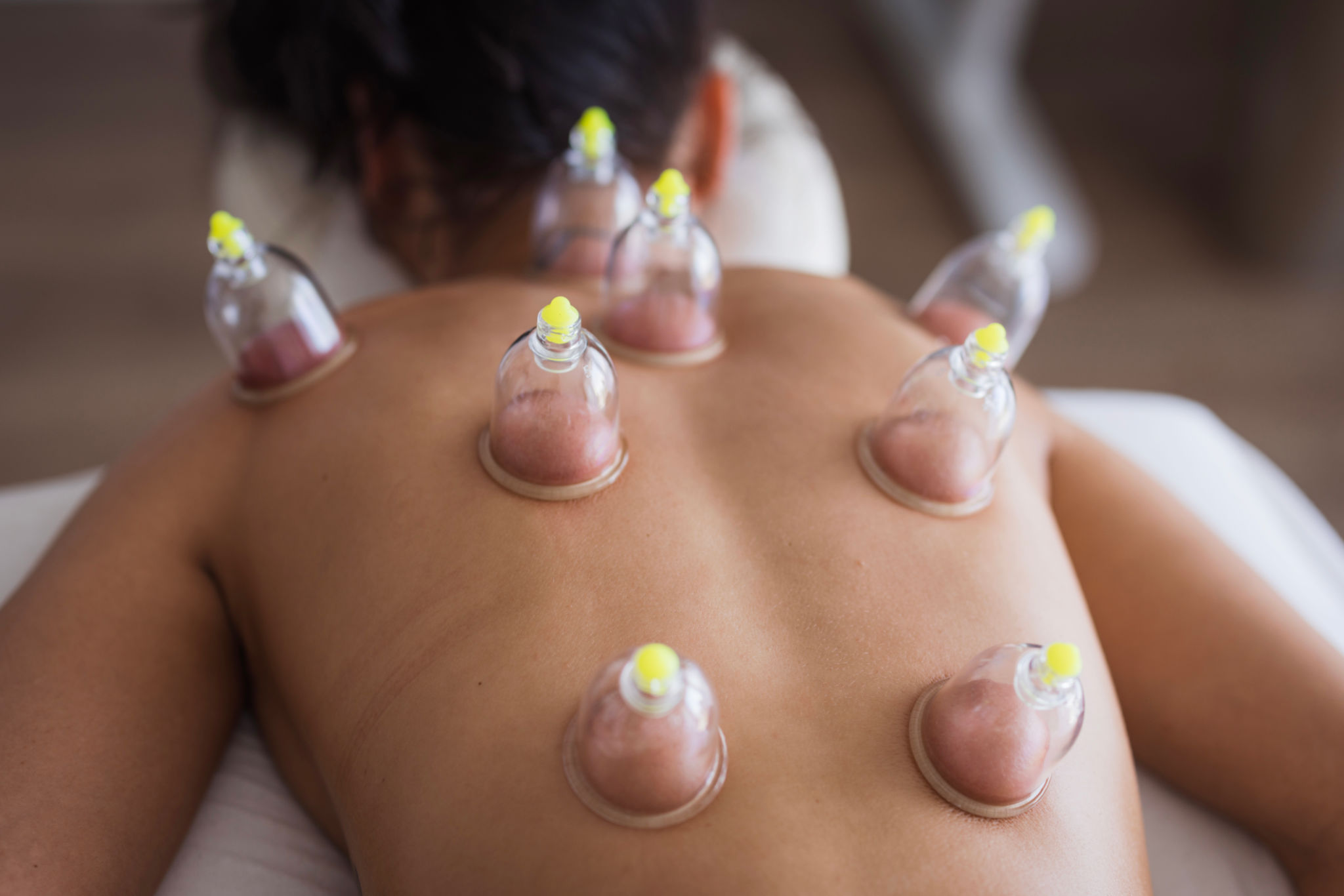 AVY SPA Natural Healing Power Therapy – combination of Gua Sha, Cupping, and Back Walking to relieve deep muscle tension and restore balance. AVY SPA Natural Healing Power Therapy – combination of Gua Sha, Cupping, and Back Walking to relieve deep muscle tension and restore balance.