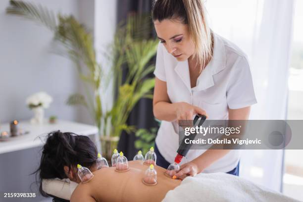 therapist performing blood suction with cups - cupping stockfoto's en -beelden
