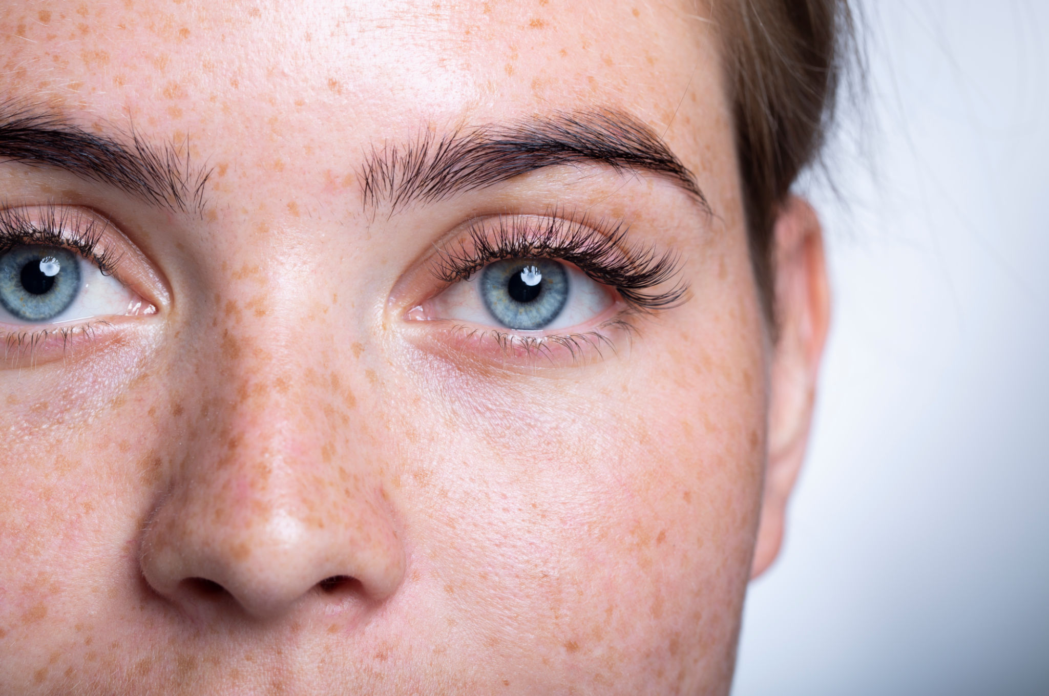 healthy eyes