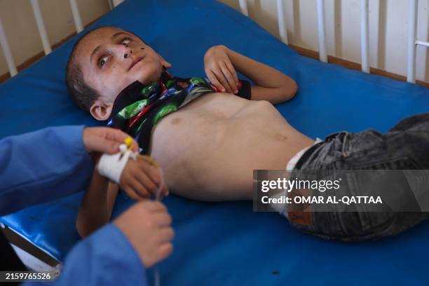 Palestinian boy Muhammad Shaaban suffering from malnutrition receives care at the Kamal Adwan hospital in Beit Lahia in the northern Gaza Strip on...