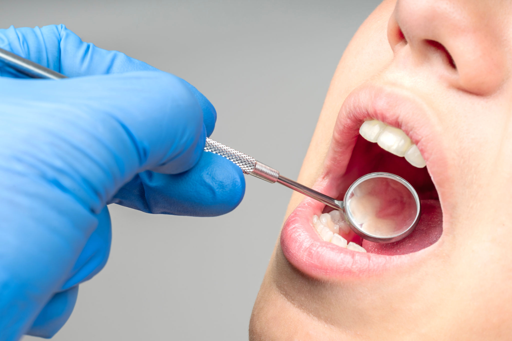 preventive dental care