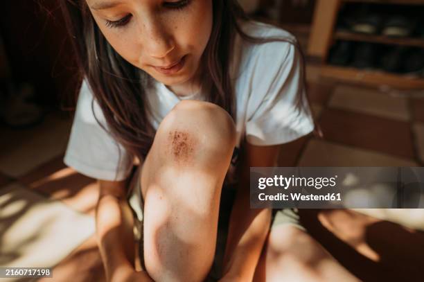 girl blowing on wounded leg sitting at home - cardenal lesión física fotografías e imágenes de stock