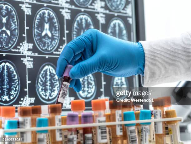 Lab Human Sample 432 Human Physiology Laboratory Stock Photos, High-Res Pictures, and ...