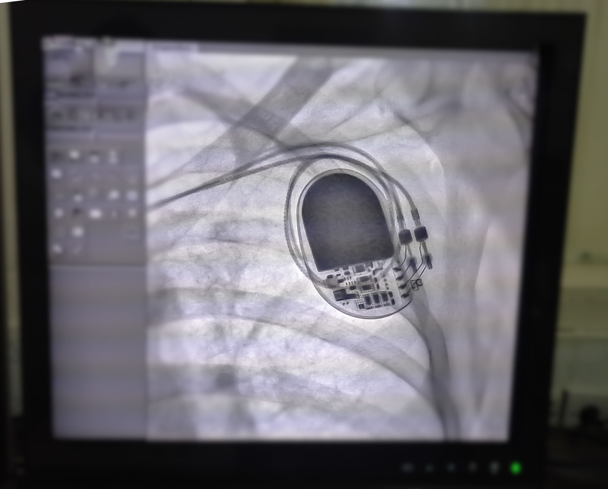 electrophysiology equipment