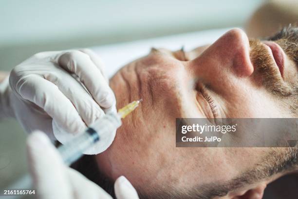 filler injection for male face in beauty clinic - ácido hialurónico imagens e fotografias de stock