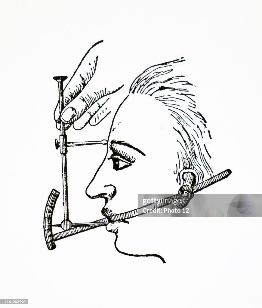 A clinometer used for measuring angles of the profile of a face