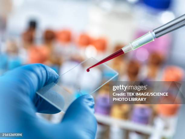 blood testing - tumeur photos et images de collection