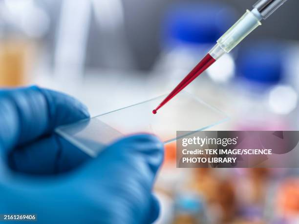 blood testing - cancer stock pictures, royalty-free photos & images