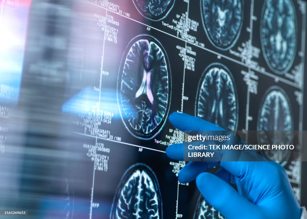 Neurology research, conceptual image