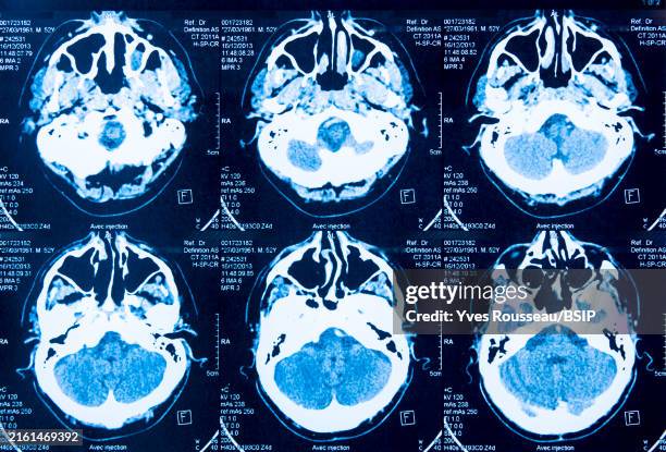 High Brain Function Scan 235 Ct Scan Brain Anatomy Stock Photos, High-Res Pictures, and Images ...