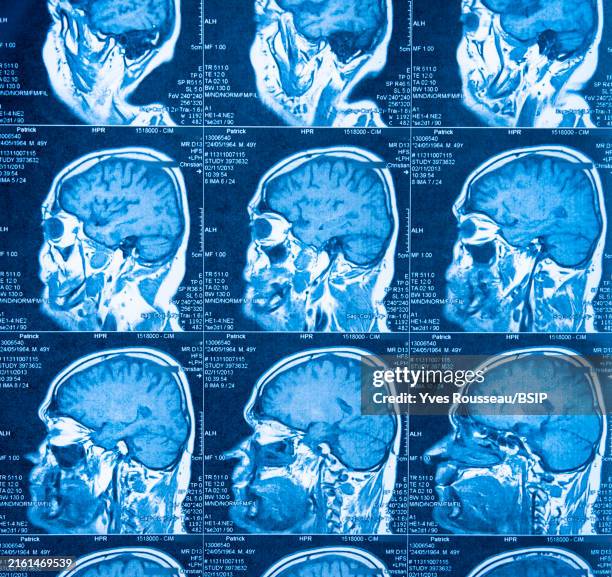 High Brain Function Scan 239 Ct Scan Brain Anatomy Stock Photos, High-Res Pictures, and Images ...