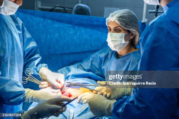 nurse assistant and doctor during surgery - hernia mesh stock pictures, royalty-free photos & images