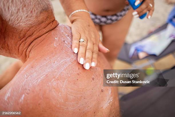 sunscreen application - melanoma stock pictures, royalty-free photos & images