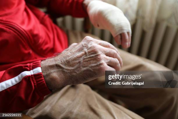 ein älterer mann mit einer handverletzung, dem der daumen fehlt. seine hand ist verbunden, nahaufnahme - wunde stock-fotos und bilder