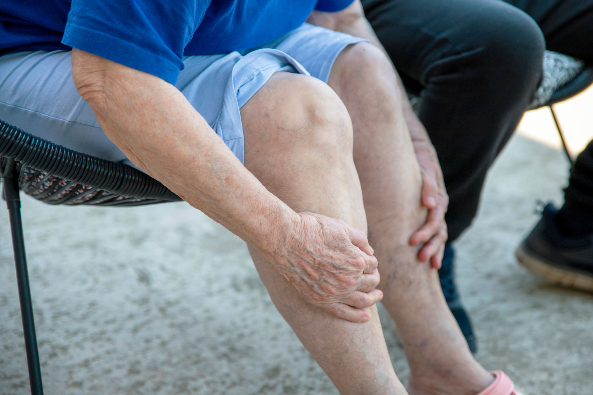 leg ulcer