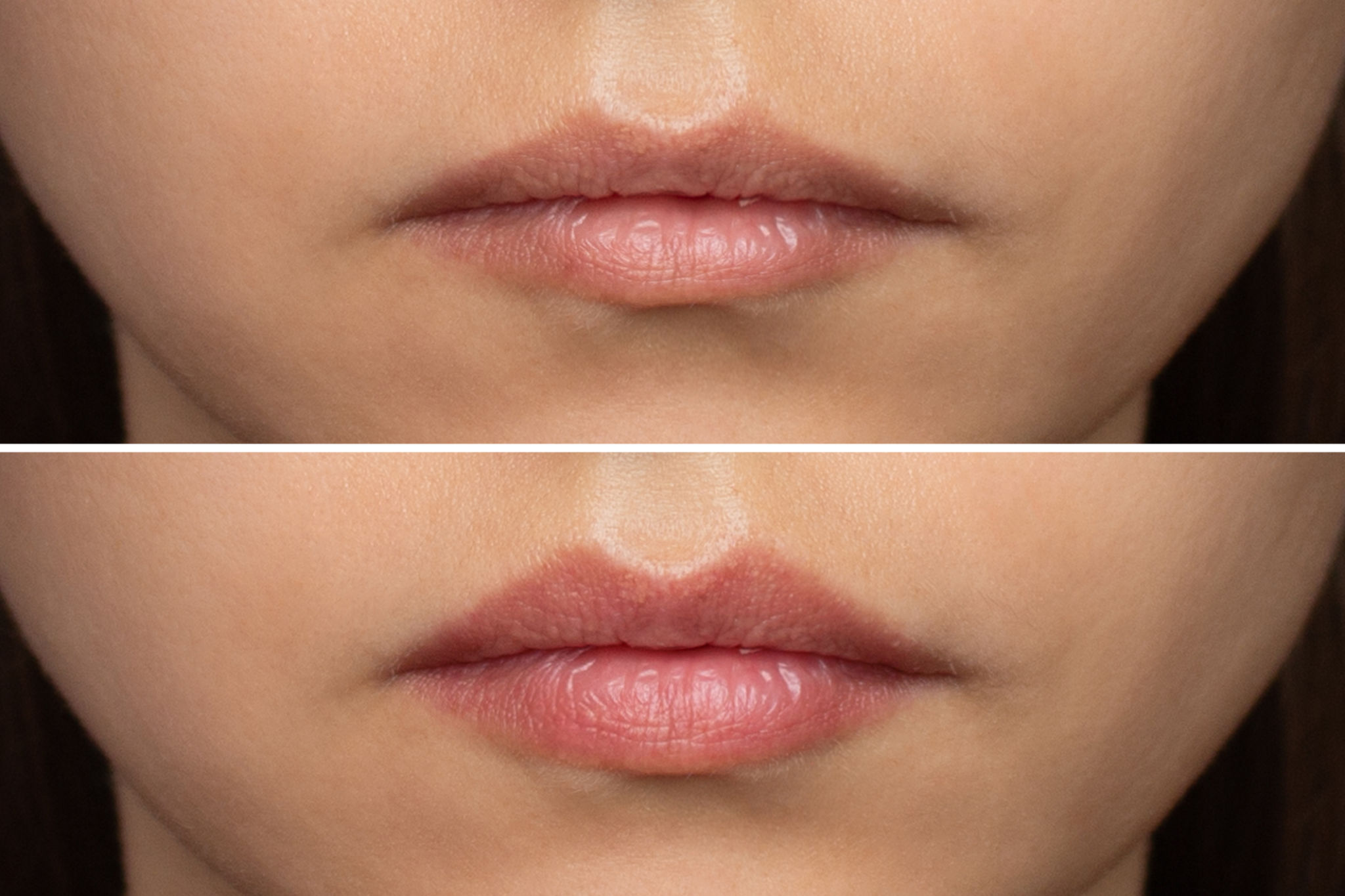 lip enhancement results