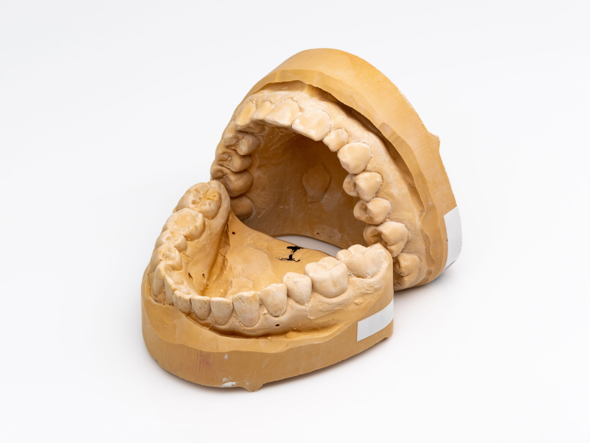 custom dental model