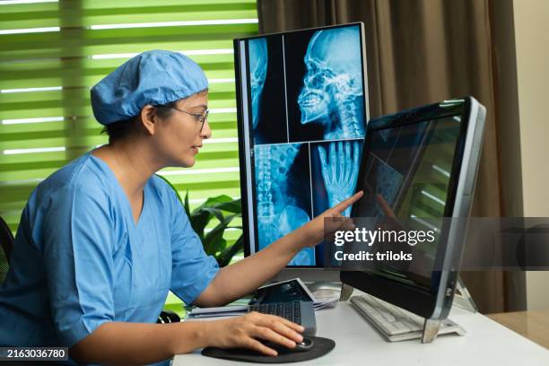 enfermeira feminina analisando raio-x na mesa no hospital - ultrasonografia médica equipamento de monitoramento - fotografias e filmes do acervo