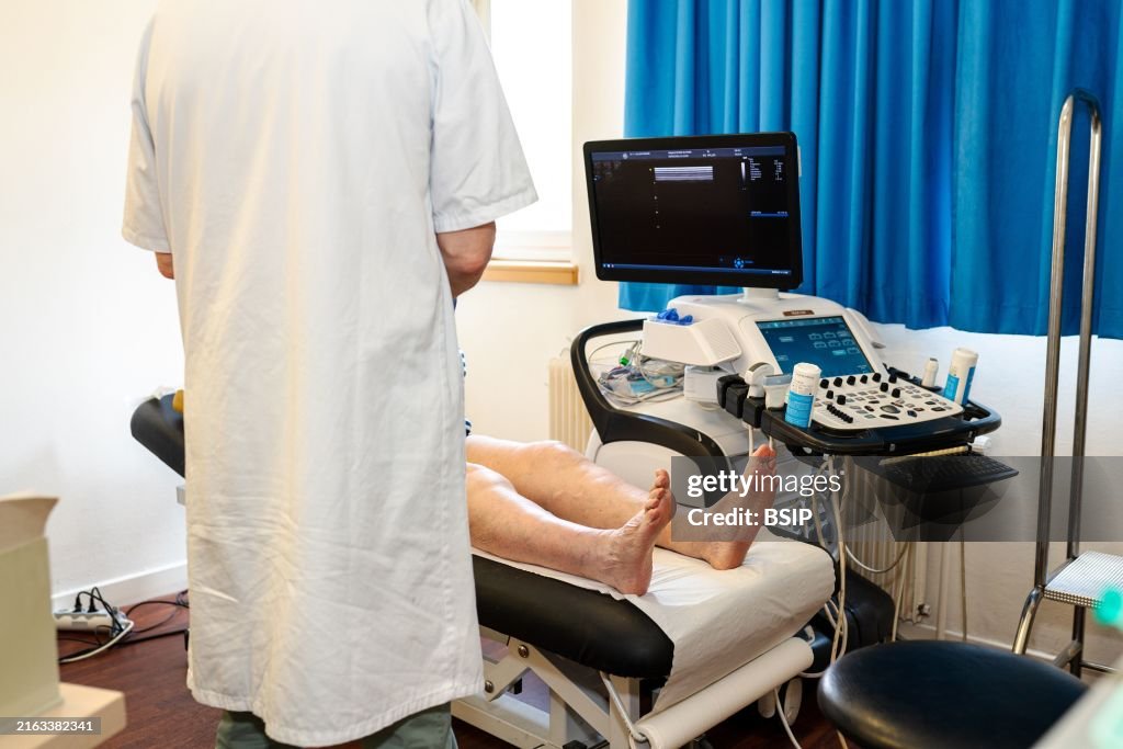 Treatment of varicose veins by foam echosclerotherapy