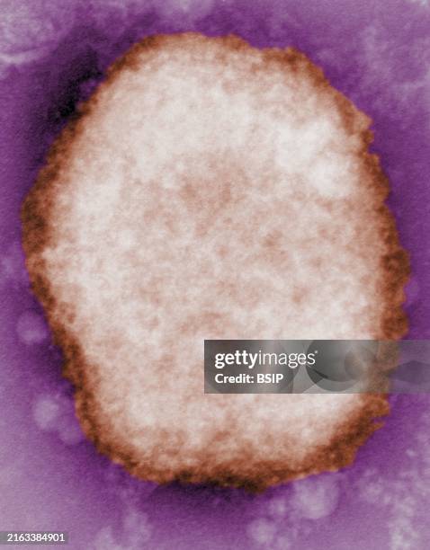 Highly magnified negative-stain transmission electron micrograph image revealing a type M monkeypox virus, or mulberry, particle that has been found...