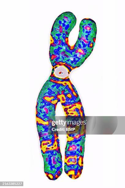 Human chromosome . They are made up of DNA which carries the genes .