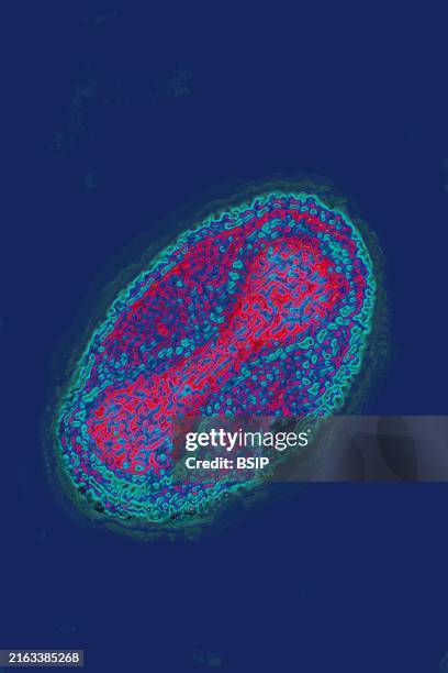 Variola virus (poxviruses are large viruses of 300/200/100 nm. They are pathogenic for humans such as smallpox and vaccinia viruses as well as animal...