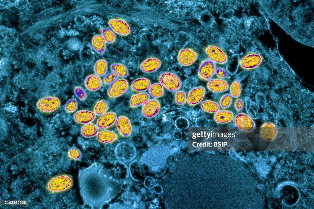 Smallpox virus